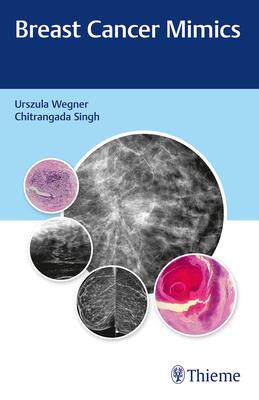 [预订]Breast Cancer Mimics 9789388257947