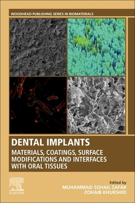 【预订】Dental Implants
