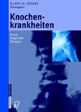预订 Knochenkrankheiten: Klinik Diagnose Therapie