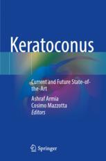【预订】Keratoconus 9783030845087