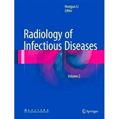 预订 Radiology of Infectious Diseases: Volume 2 传染病放射学 第2卷: 9789401798754