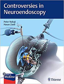 【预售】Controversies in Neuroendoscopy