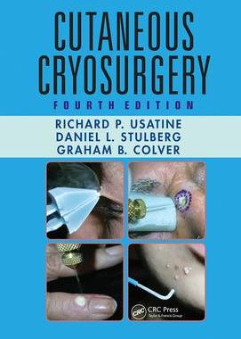[预订]Cutaneous Cryosurgery 9781032243023