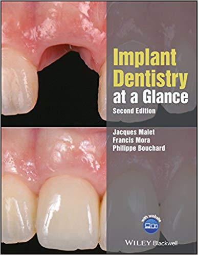 美国库房发货,通常付款后5-8周到货!