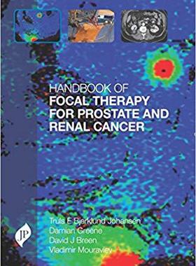 【预售】Handbook of Focal Therapy for Prosta...