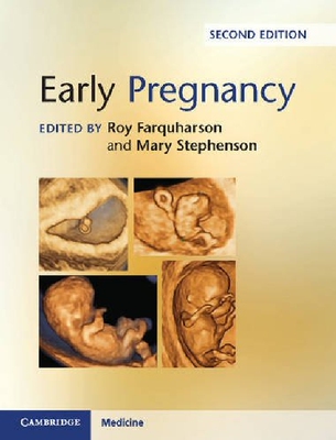 【预订】Early Pregnancy