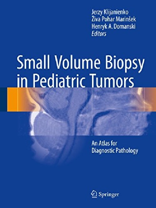 【预订】small volume biopsy in pediatric tum.