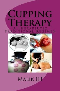 【预订】Cupping Therapy: A Therapeutic Tradi...