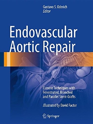 【预订】Endovascular Aortic Repair