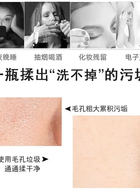 毛孔去黑头按摩膏净化霜收缩毛孔清洁角质清洁霜温和毛囊面部粉刺