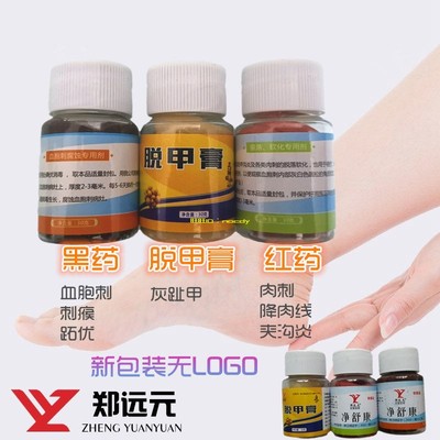 郑远元官方旗舰店红药黑药脱甲膏