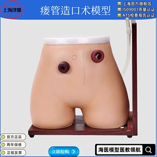 造口模型 高级瘘管造口术护理模型 结肠回肠造瘘教学模型 造口冲