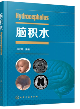 脑积水 林志雄 脑手术技巧 神经外科颅底手术入路 显微外科神经内镜 脑血管 脑外科颅脑损伤 神经外科学书 神经内科外科医师参考书