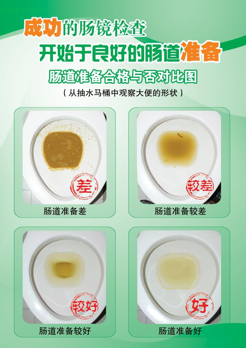 检查肠道准备合格图 大小便形状颜色检测检验合格胃镜检查提示标贴