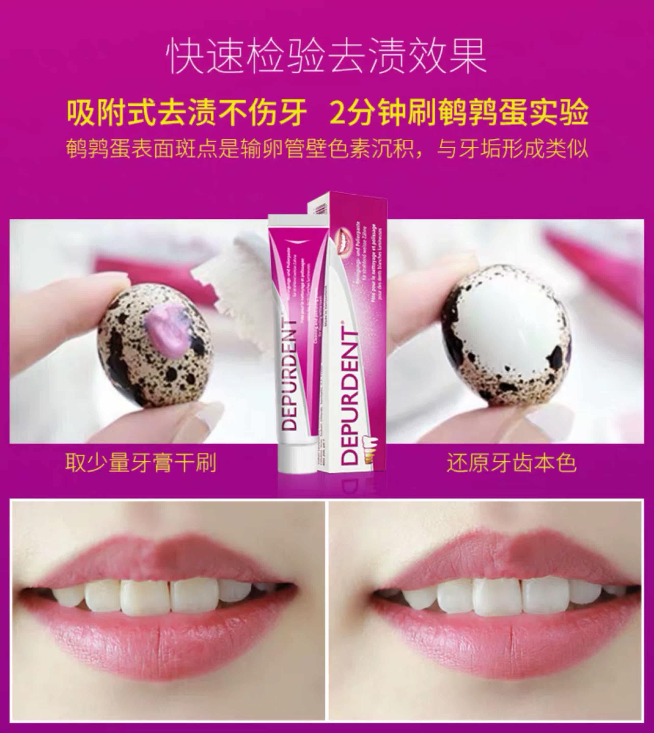 4周去黄牙！瑞士dr.wild怀尔德牙膏depurdent去烟渍黄牙渍抛光|msdalam kategori Care pembersih/tuala wanita/kertas/Aromatherapy, Rambut dan badan/kebersihan peribadi, Penjagaan oral, ubat gigi - dari Buy2taobao.com untuk memberikan perkhidmatan ejen Taobao profesional membeli