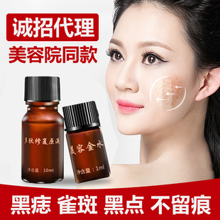 点斑水无痕正品美容院专用去脸上黑痣痦子手上老年斑祛遗传雀斑药