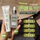 痘肌可用韩国Fation梵蒂爱舒缓修复精华液泛红敏感肌淡化痘印面霜