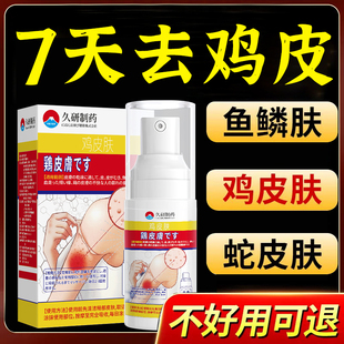 去鸡皮肤毛囊角化症专用药去除鸡皮疙瘩毛周角质化专用修复膏神器