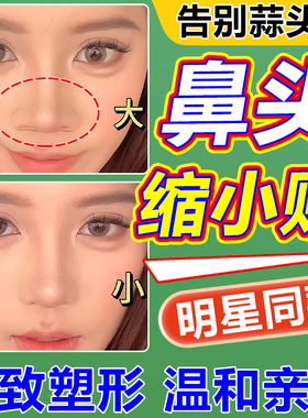 鼻头缩小贴变小神器热塑美鼻夹板变高挺鼻翼梁固定矫正自捏塑形器