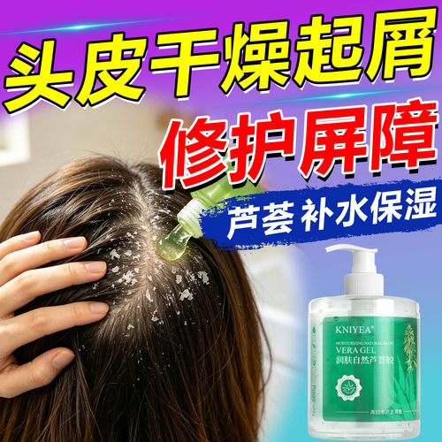 头皮干燥起屑掉白皮紧绷发痒换季敏感芦荟胶温和补水保湿修护舒缓