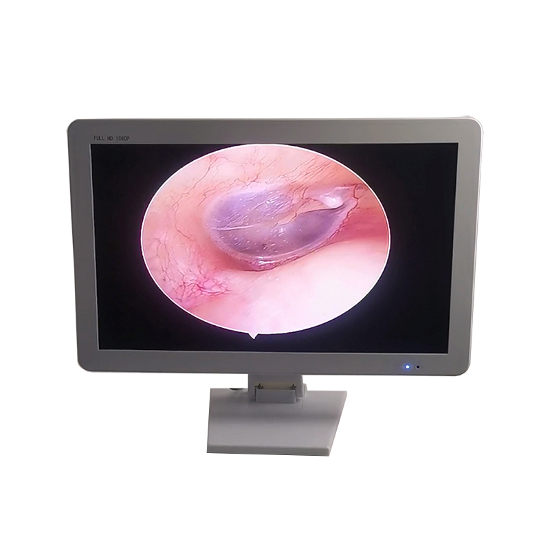 上海馨迪可视采耳内窥镜工业电子影像检查仪21.5寸全高清显示器
