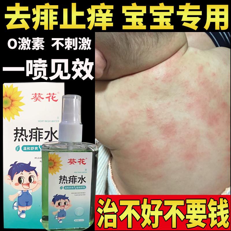 宝宝热痱子水儿童婴儿专用止痒水液体防去痱子喷雾婴幼儿祛痱洗澡