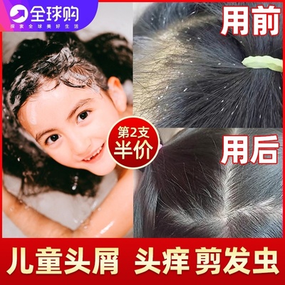 剪发虫儿童洗发水儿专用女孩6 12岁以上女童去屑止痒洗发露头男童