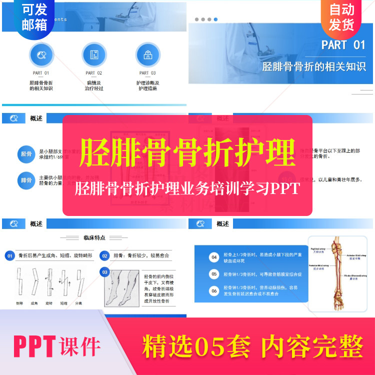 胫腓骨骨折护理业务培训学习ppt成品课件模板胫腓骨折护理查房ppt