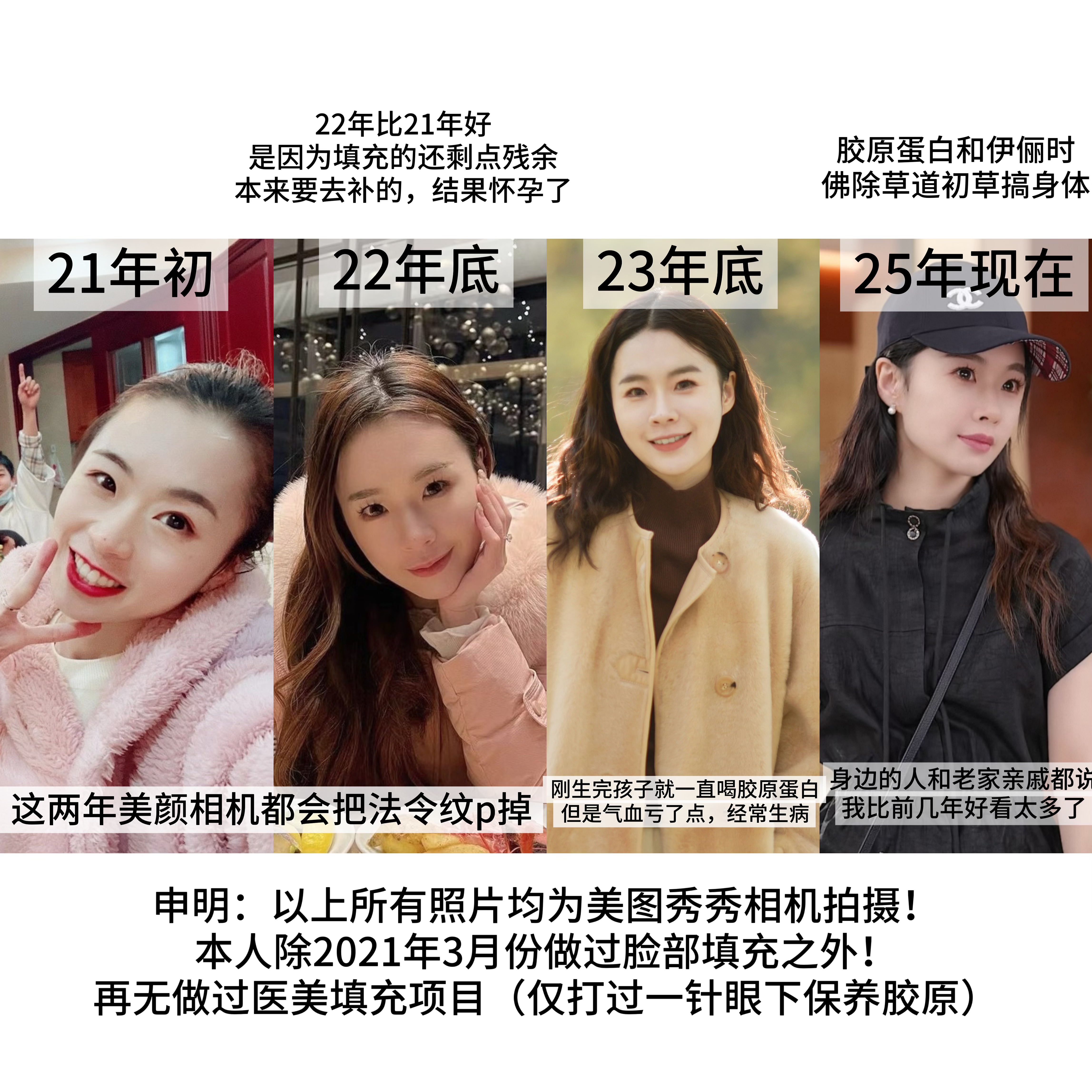 小丸子之前照片