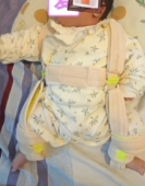 Pavlik吊带髋外展矫正带