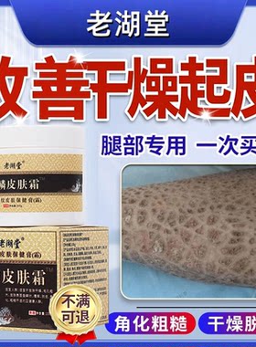 【鱼鳞病皮肤霜】鸡皮肤去除专用