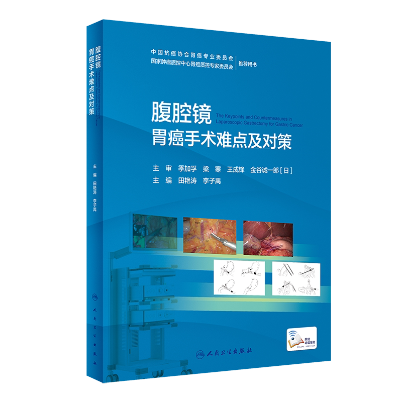 腹腔镜胃癌手术难点及对策