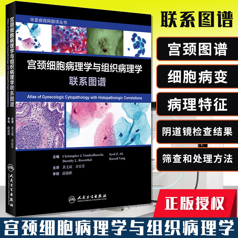 宫颈细胞病理学与组织病理学联系图谱 本书除了介绍正常宫颈感染性疾病等细胞学特征外还专门介绍了各种宫颈病变的阴道镜检查结果