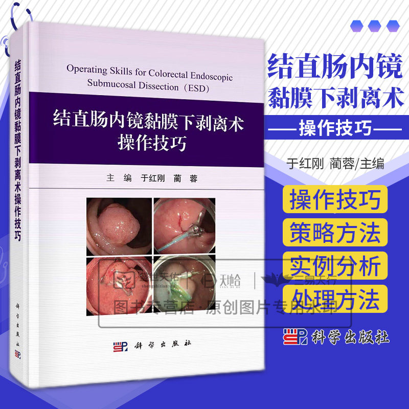 结直肠内镜黏膜下剥离术操作技巧 于红刚 蔺蓉主编 科学出版社 结直肠ESD的基本操作及要点 缺血性结肠炎 护理及麻醉团队的配合