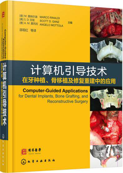 计算机引导技术在牙种植.骨移植及修复重建中的应用  M里纳尔迪Marco Rinaldi 化学工业出版社 适用于口腔种植医师及相关医学生