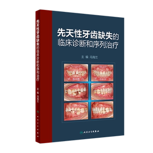先天性牙齿缺失的临床诊断和序列治疗 先天性缺牙的分类 先天性缺牙的发病率 冯海兰编著 9787117311694 人民卫生出版社