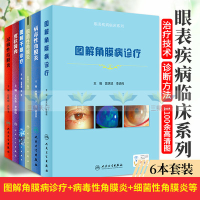 眼表疾病临床系列 图解角膜病诊疗+病毒性角膜炎+细菌性角膜炎+图解干眼诊疗+翼状胬肉+过敏性结膜炎 套装6本 人民卫生出版社