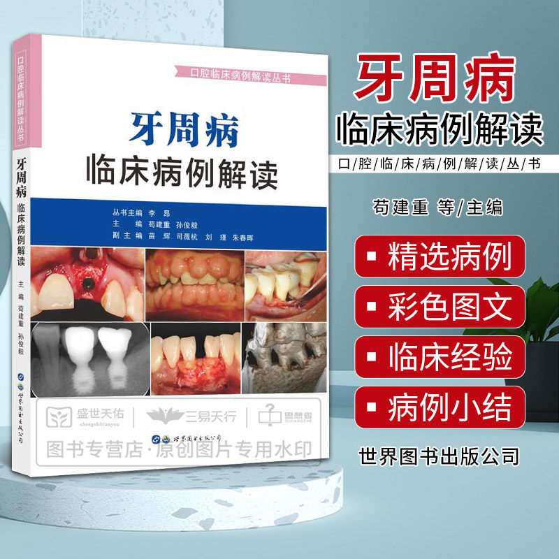 牙周病临床病例解读 口腔临床病例解读丛书 苟建重 孙俊毅等 牙龈病牙周炎及伴发病变慢性龈炎妊娠期龈炎等 世界图书西安