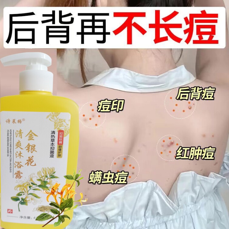 金银花止痒沐浴露除螨后背清洁清爽清洁沐浴乳液去痱凉爽正品
