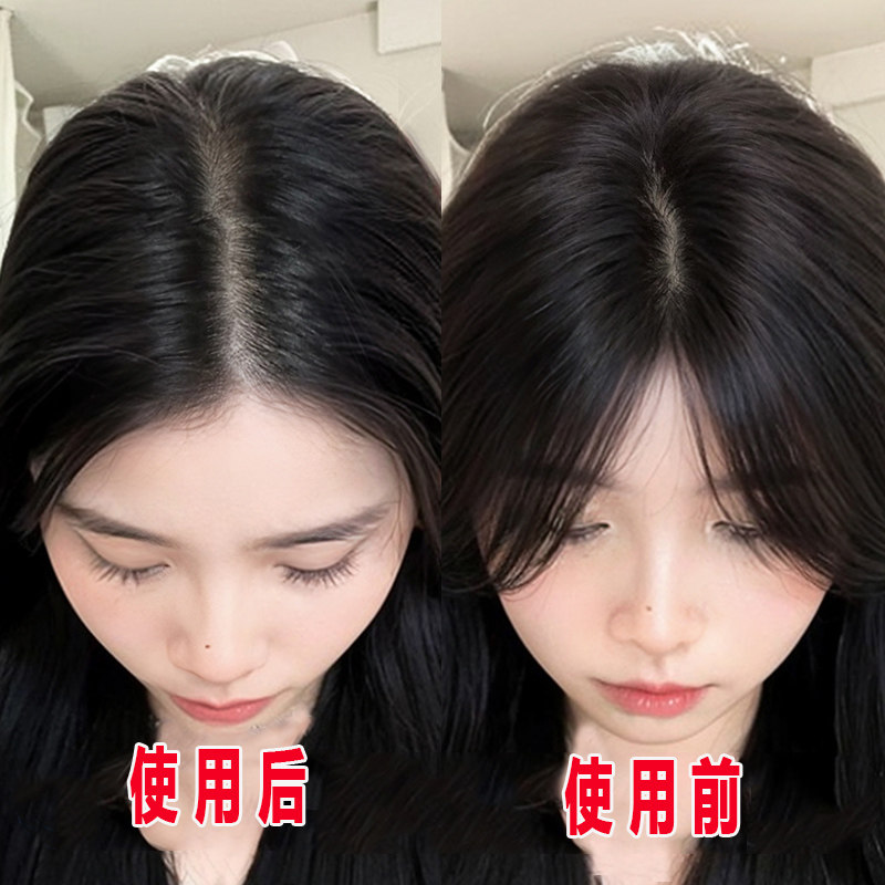 小红书推荐 12天防脱密发 生发增发 适合脂溢性掉发男女通用 2发3