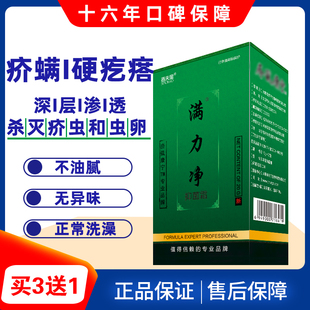 疥疮结节疥螨疙瘩专用男女儿童止痒杀疥虫卵疥虱康宁满力净抑菌霜