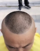 成人理发模型锅盖头短发剃头辅助神器自己完成