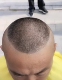 成人理发模型锅盖头短发剃头辅助神器自己完成
