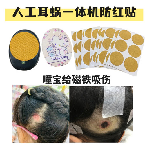 人工耳蜗一体机防汗防红贴不留胶RONDO1 RONDO2 RONDO3