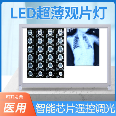 邦惠贝X光观片灯观片灯led牙科箱阅片灯三联观片灯双联骨科单联灯