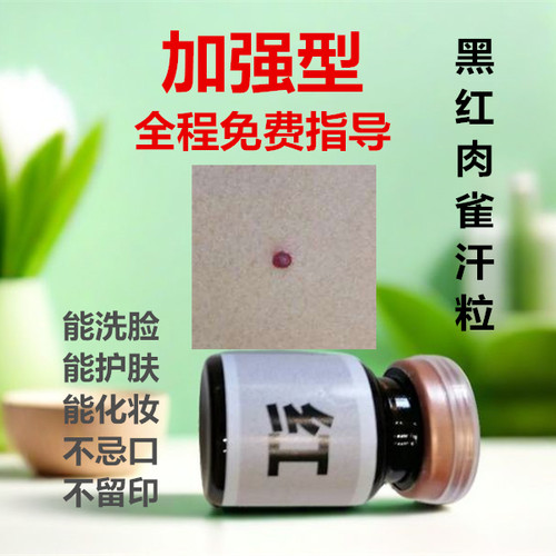 去痣点痣膏无恨正品取痣红痣丝状汗管肉痣黑痣黑点雀斑药水美容仪