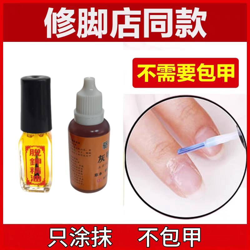 快速脱甲精油无痛脱甲液软化指甲修复液灰甲软甲水冰醋酸去除杀菌