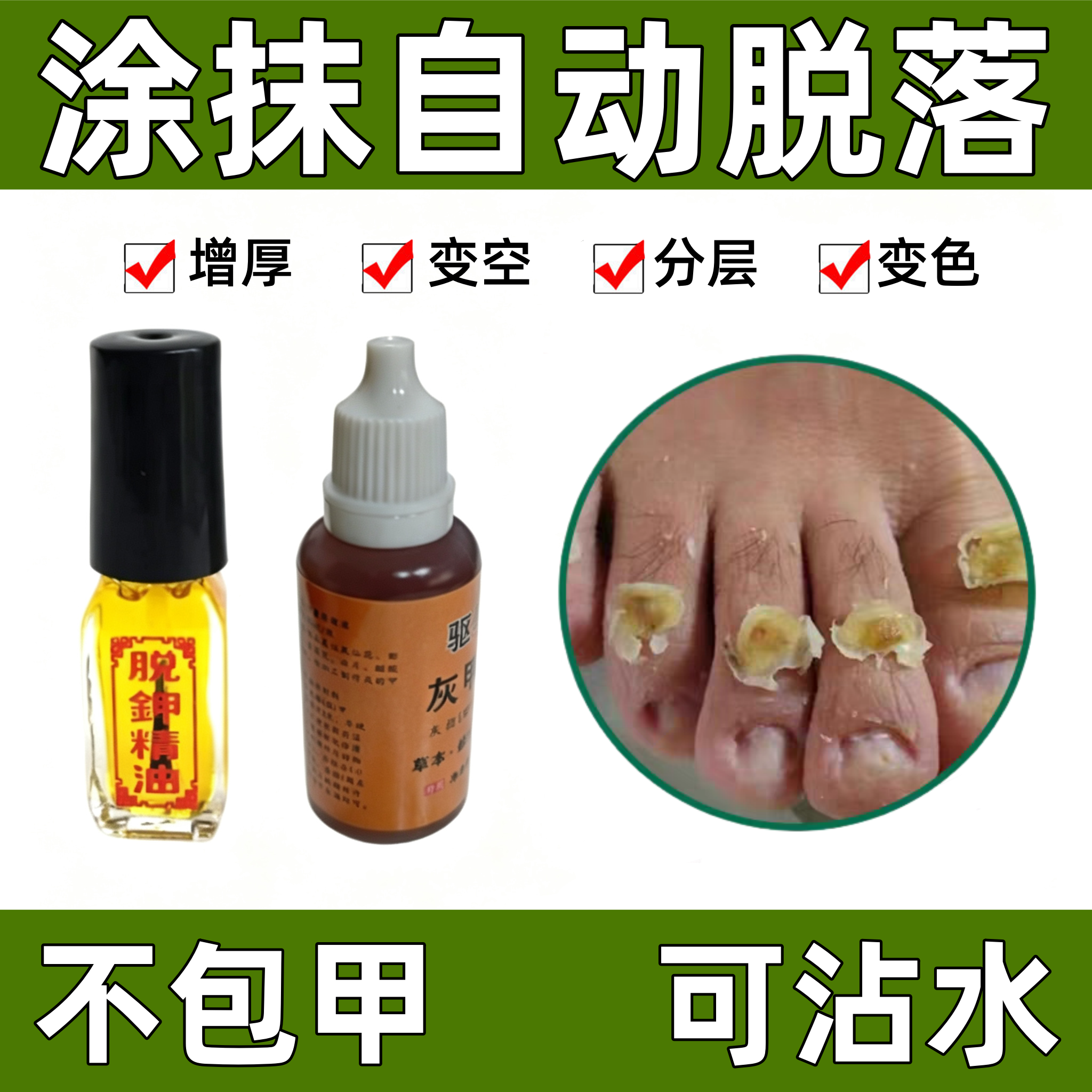 脱甲精油祛灰指甲专用抑菌液去除灰指甲增厚软甲脱甲膏灰甲净正品