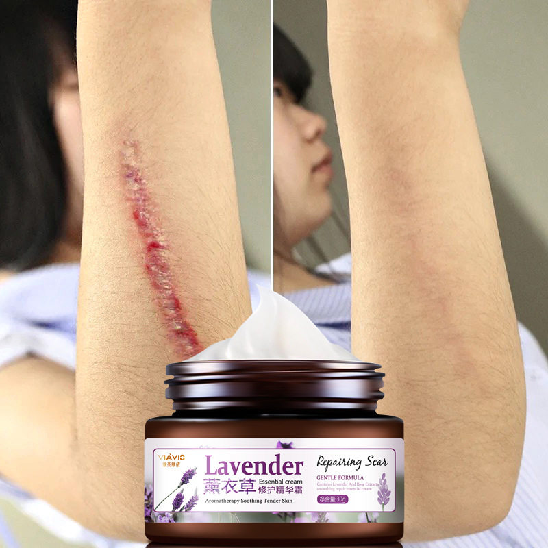 [依丽雅美妆身体护理套装]薰衣草修复精华霜 改善妊娠纹烫伤剖腹月销量1件仅售108元