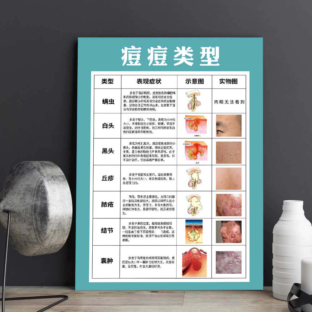 痘痘类型海报痤疮分类图片面部粉刺形成美容院面部护理KT泡沫板画